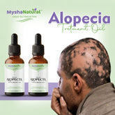 Mysha Natural Special Alopecia Treatment Oil – Herbal Hair Regrowth Formula for Patchy Hair Loss (15ml) (Pack Of 2)
