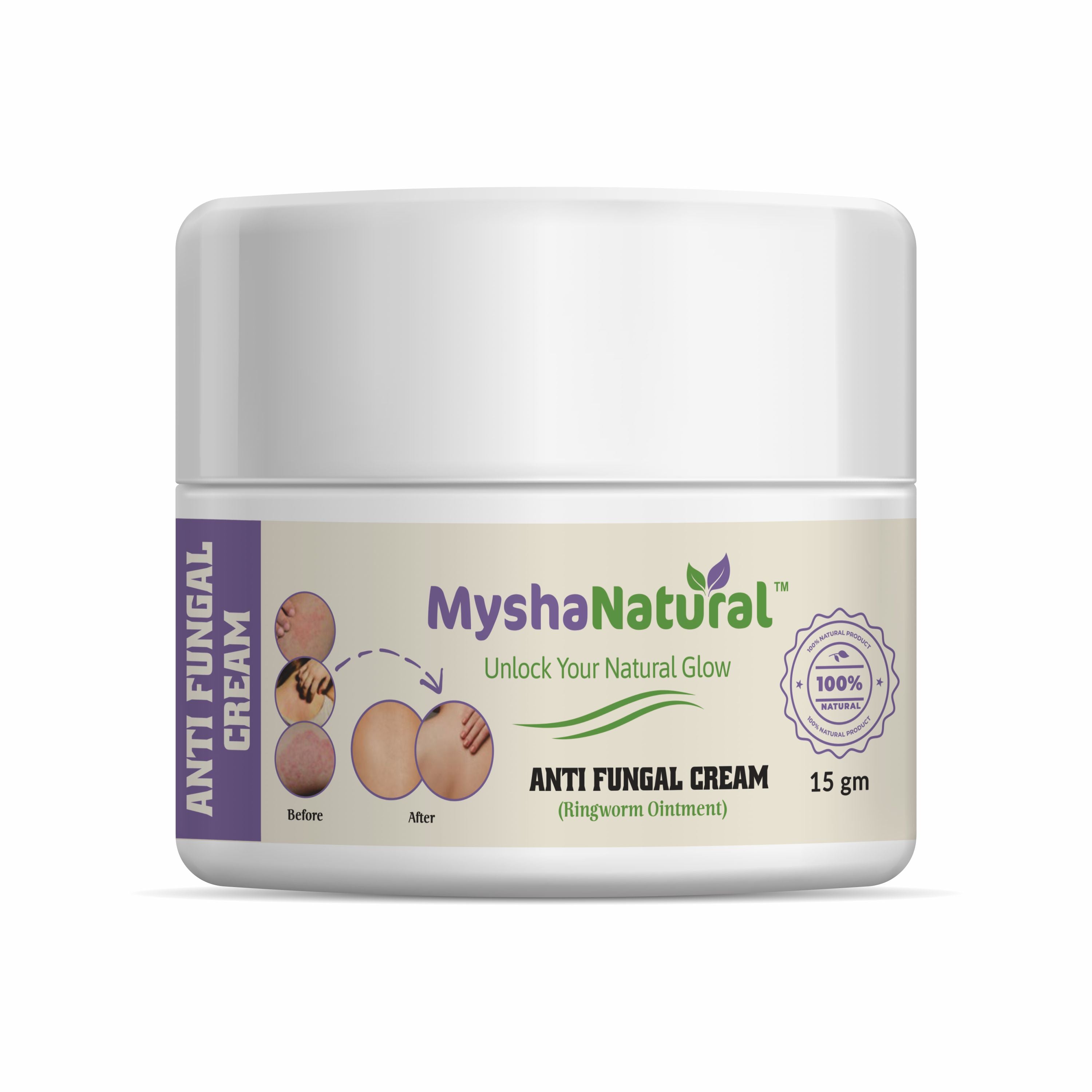 MyshaNatural™ Anti Fungal Cream – Ringworm & Skin Infection Ointment – 15g