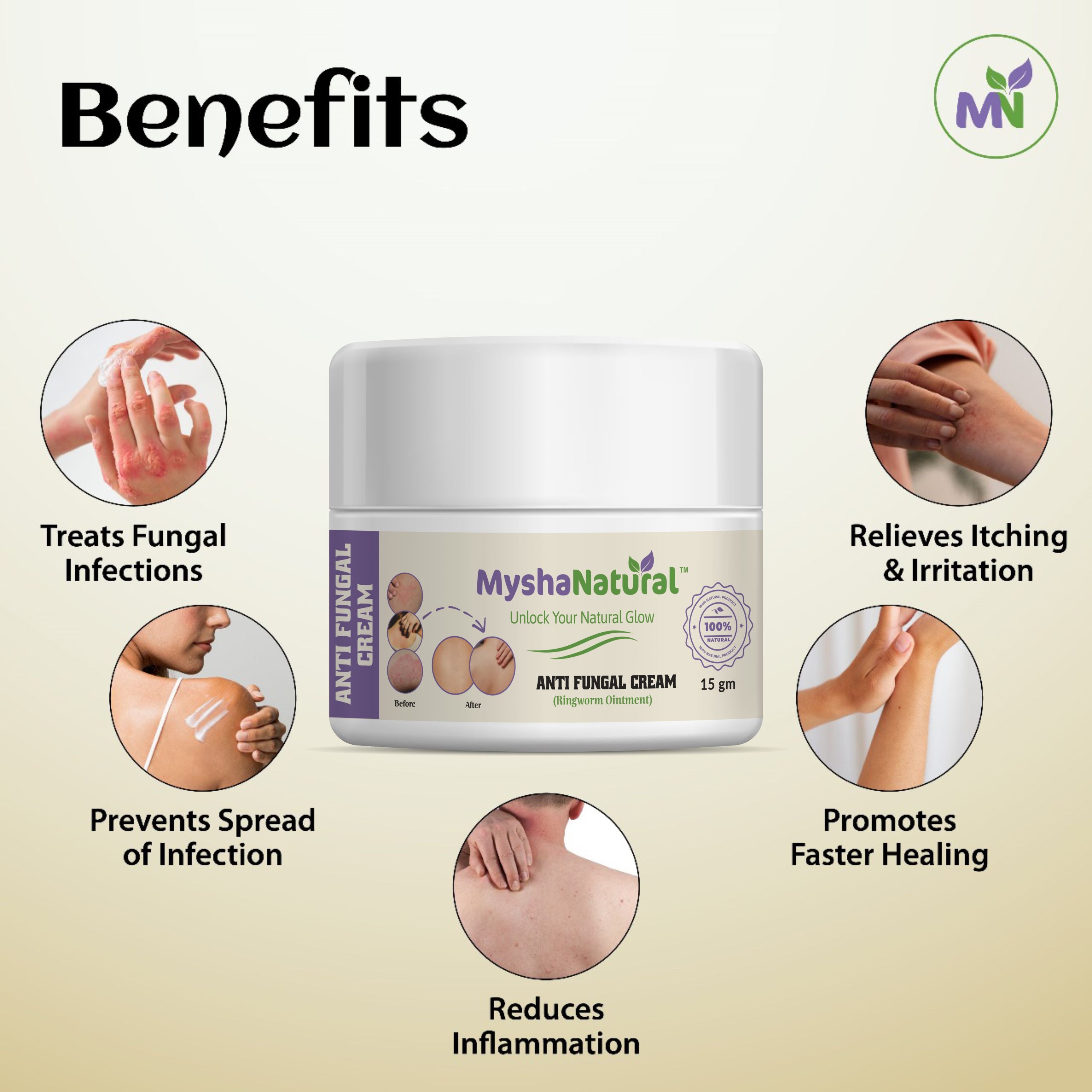 MyshaNatural™ Anti Fungal Cream – Ringworm & Skin Infection Ointment – 15g