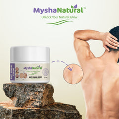 MyshaNatural™ Anti Fungal Cream – Ringworm & Skin Infection Ointment – 15g