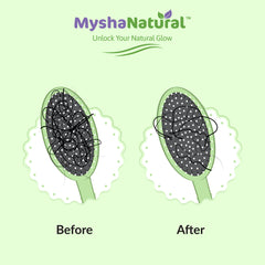 MyshaNatural™ Hair Care Combo – Dandruff Hair Oil (50 ml) + Zero Hair Fall Oil (100 ml) + Natural Shampoo (200 ml)